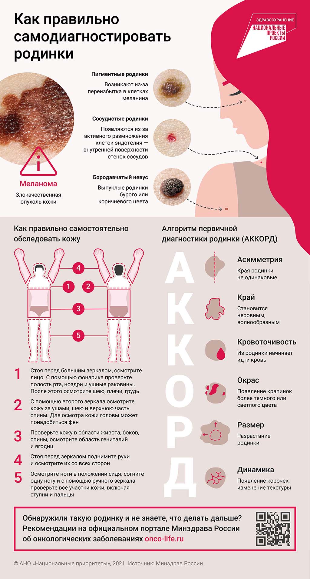 Как Выглядят Родинки Фото